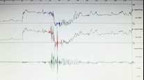 Good Urodynamic Practices – Pressure Flow Analysis WG27